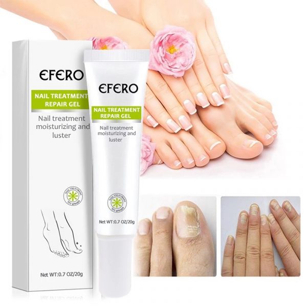 Efero Nail Repair Gel Fungus Treatment Solution Anti fungal Removal Infection Cuticle Toe Nail Foot